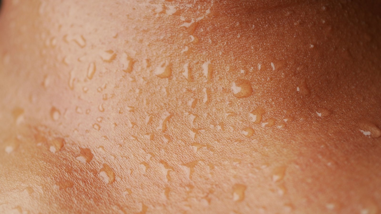 Laser Treatments